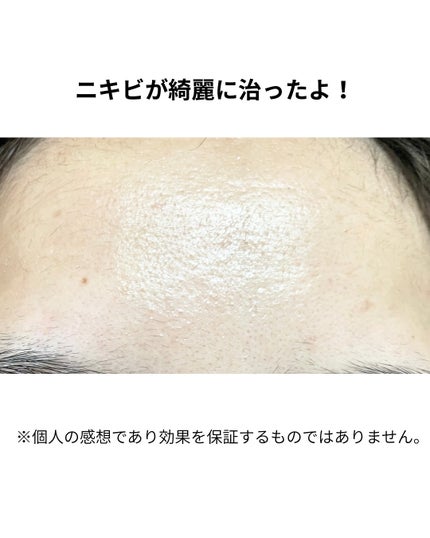 ダーマジェンシー ゼロカ81 セラム/DERMAGENCY/美容液を使ったクチコミ(2枚目)