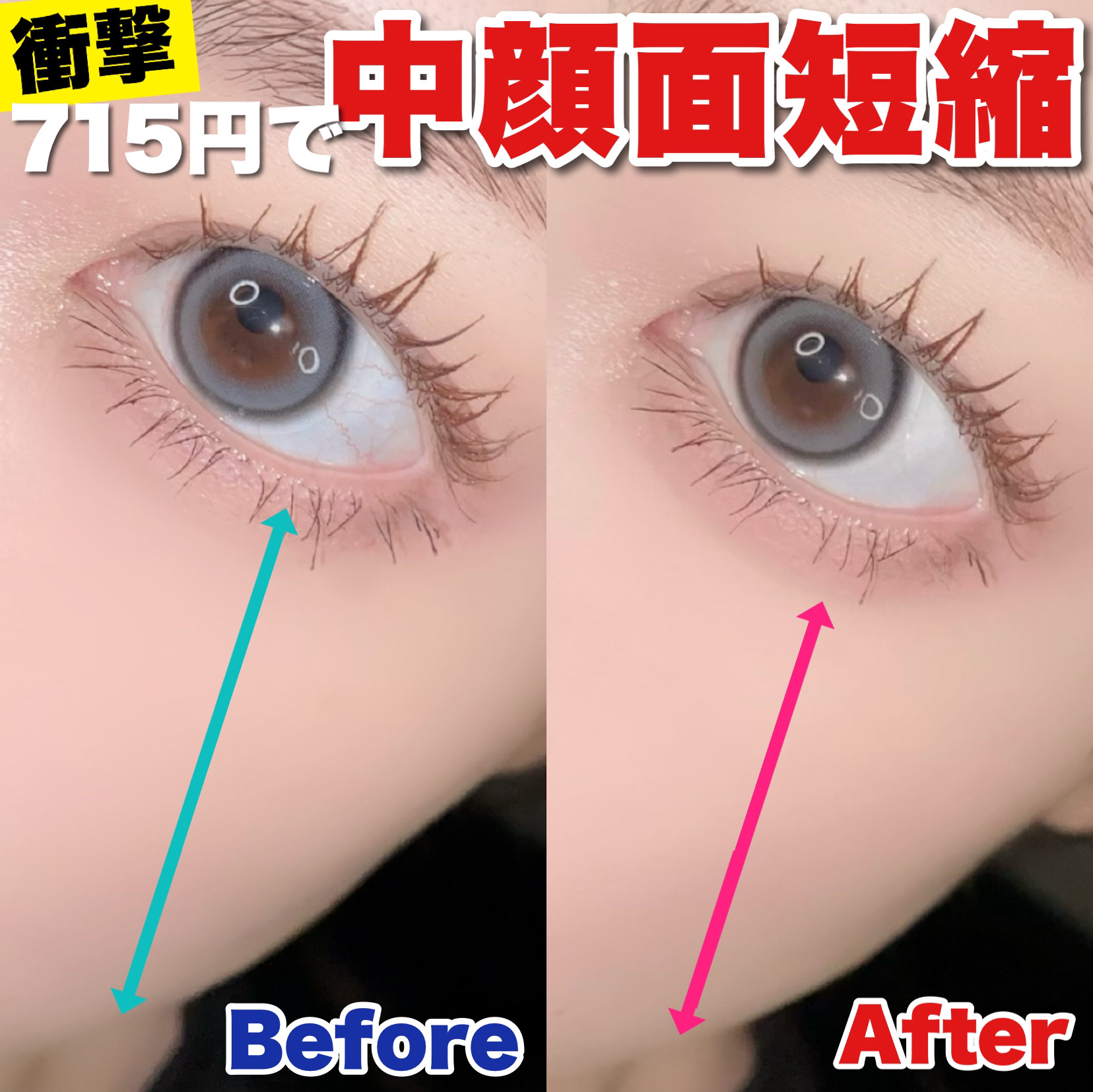 アイバッグコンシーラー/キャンメイク/ペンシルコンシーラーを使ったクチコミ（1枚目）