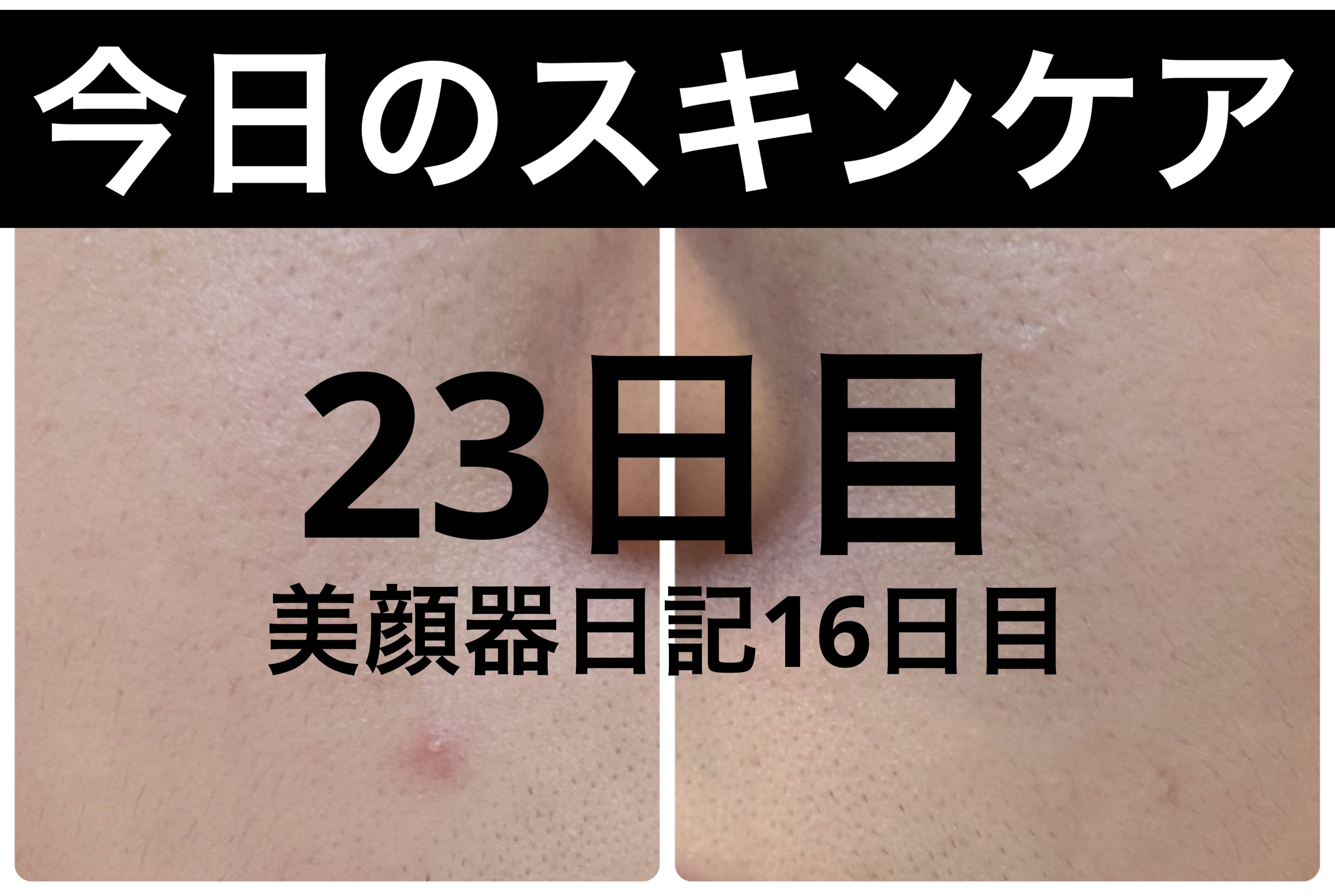 薬用雪肌精 ブライトニング クレンジング オイル[医薬部外品]/雪肌精/オイルクレンジングを使ったクチコミ（1枚目）