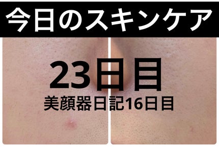 AGE-R ブースタープロ/MEDICUBE/美顔器・マッサージを使ったクチコミ(1枚目)