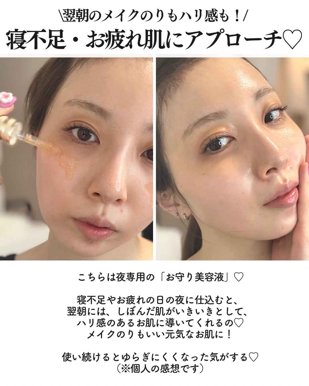 アドバンス ナイト リペア SMR コンプレックス/ESTEE LAUDER/美容液を使ったクチコミ(3枚目)