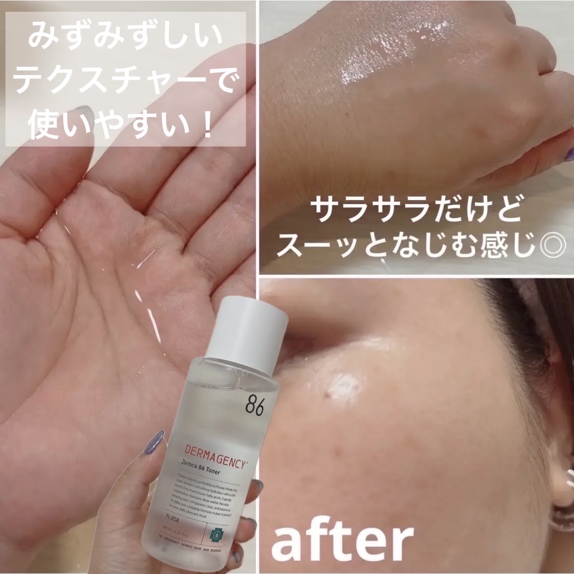 ダーマジェンシー ゼロカ86 トナー/DERMAGENCY/化粧水を使ったクチコミ（3枚目）