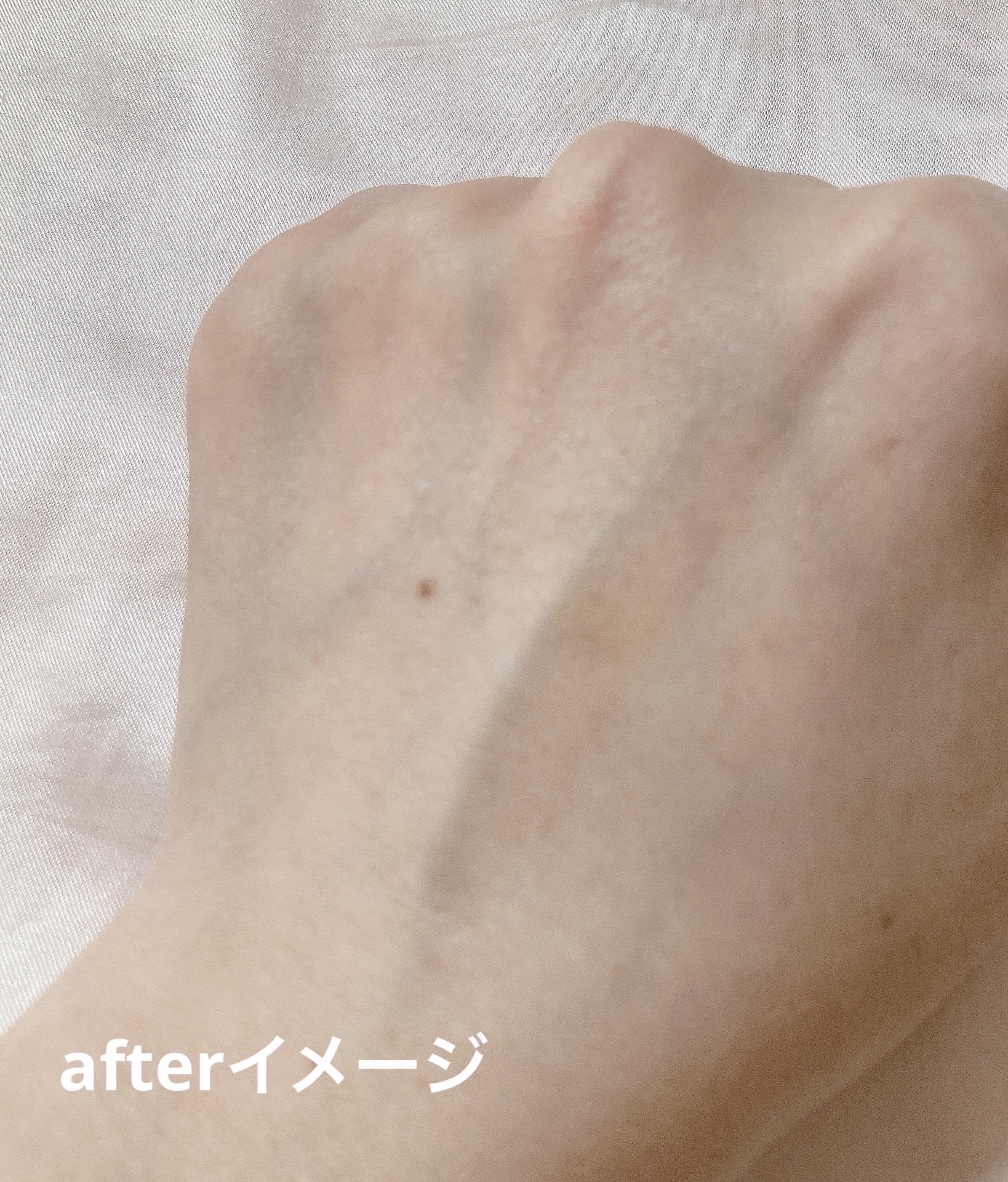 ダーマジェンシー ゼロカ81 クリーム/DERMAGENCY/フェイスクリームを使ったクチコミ（3枚目）