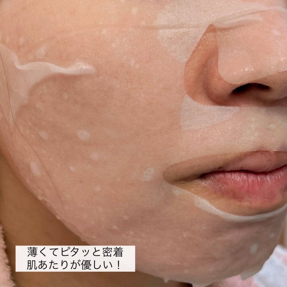 マデカッソシド エッセンシャルマスク/MEDIHEAL/シートマスク・パックを使ったクチコミ(5枚目)