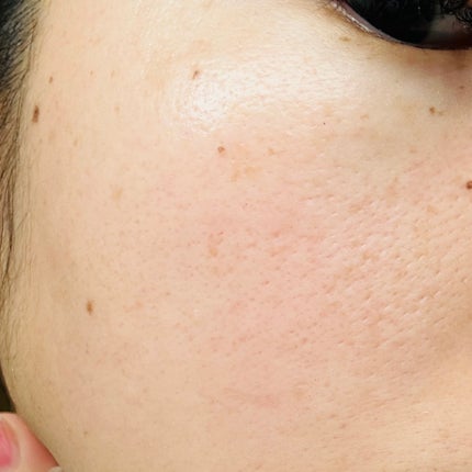 リペア洗顔フォーム/リソウコーポレーション/洗顔フォームを使ったクチコミ(4枚目)