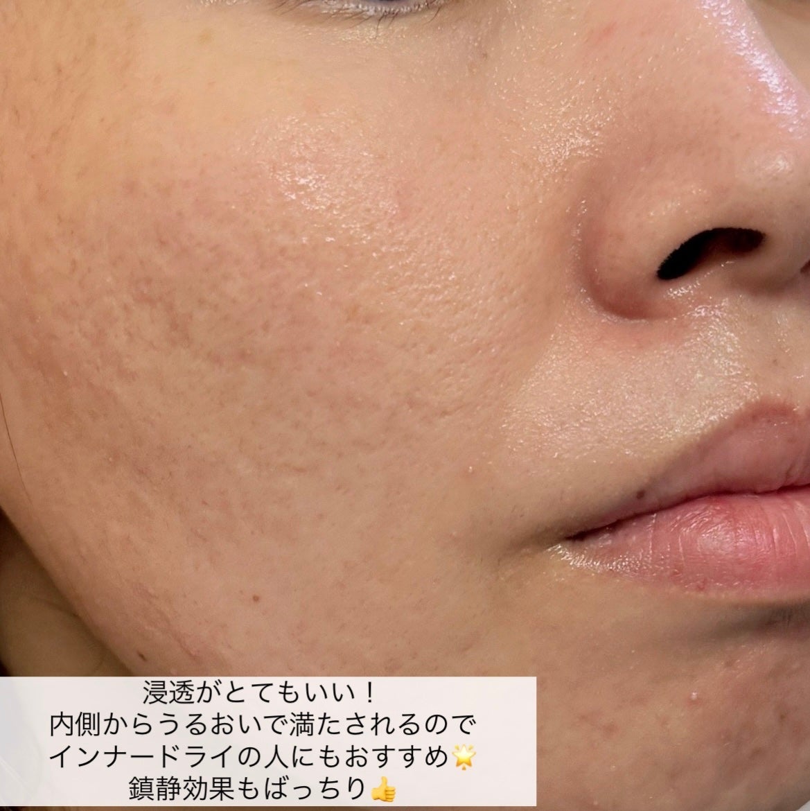 マデカッソシド エッセンシャルマスク/MEDIHEAL/シートマスク・パックを使ったクチコミ(6枚目)