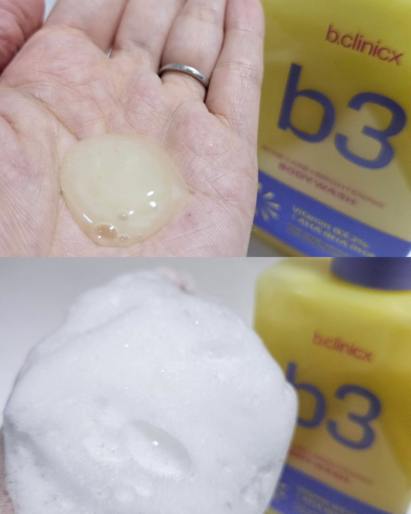 ナイアシンアミド 5% ボディローション/b.clinicx/ボディローションを使ったクチコミ(2枚目)