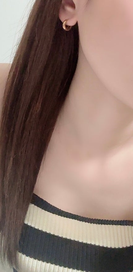 ダーマジェンシー ゼロカ86 トナー/DERMAGENCY/化粧水を使ったクチコミ(2枚目)