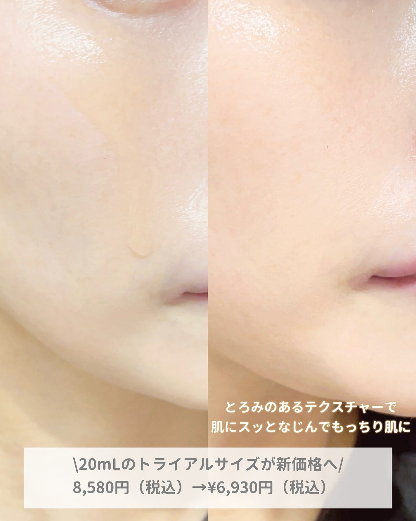 アドバンス ナイト リペア SMR コンプレックス/ESTEE LAUDER/美容液を使ったクチコミ(4枚目)