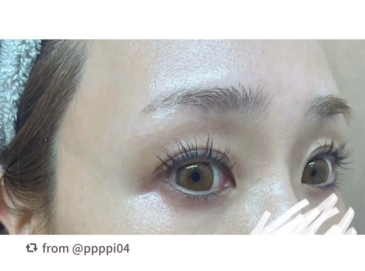 @ppppi04様、素敵な投稿ありがとうございます❤️ ̖́-

リアルなビフォア写真をシェアいただき、とても参考になりました！
エマーキットを選んでくださり、さらに正規購入への注意喚起もありがとうございます🙏

【ppppi0