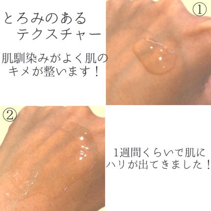 ジェニフィック アルティメ セラム/LANCOME/美容液を使ったクチコミ(3枚目)