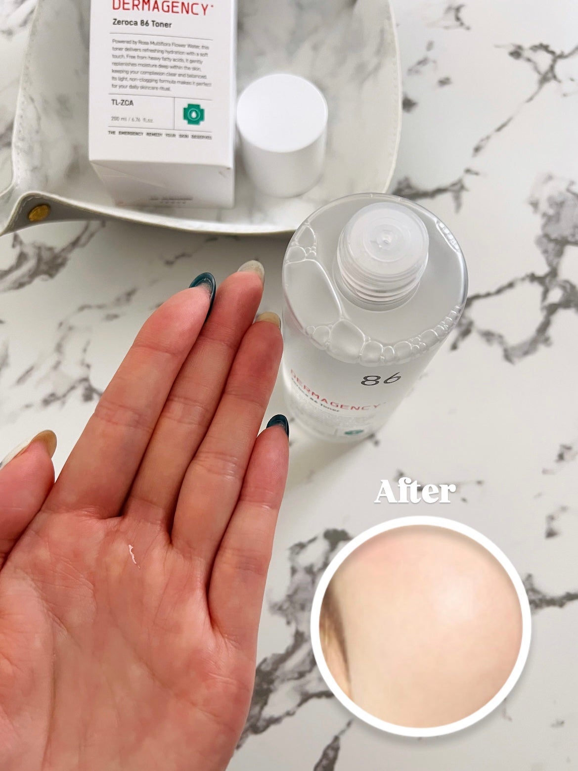 ダーマジェンシー ゼロカ86 トナー/DERMAGENCY/化粧水を使ったクチコミ(3枚目)