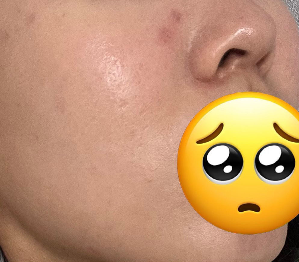 セカンドスキングロウクッション/hince/クッションファンデーションを使ったクチコミ（2枚目）