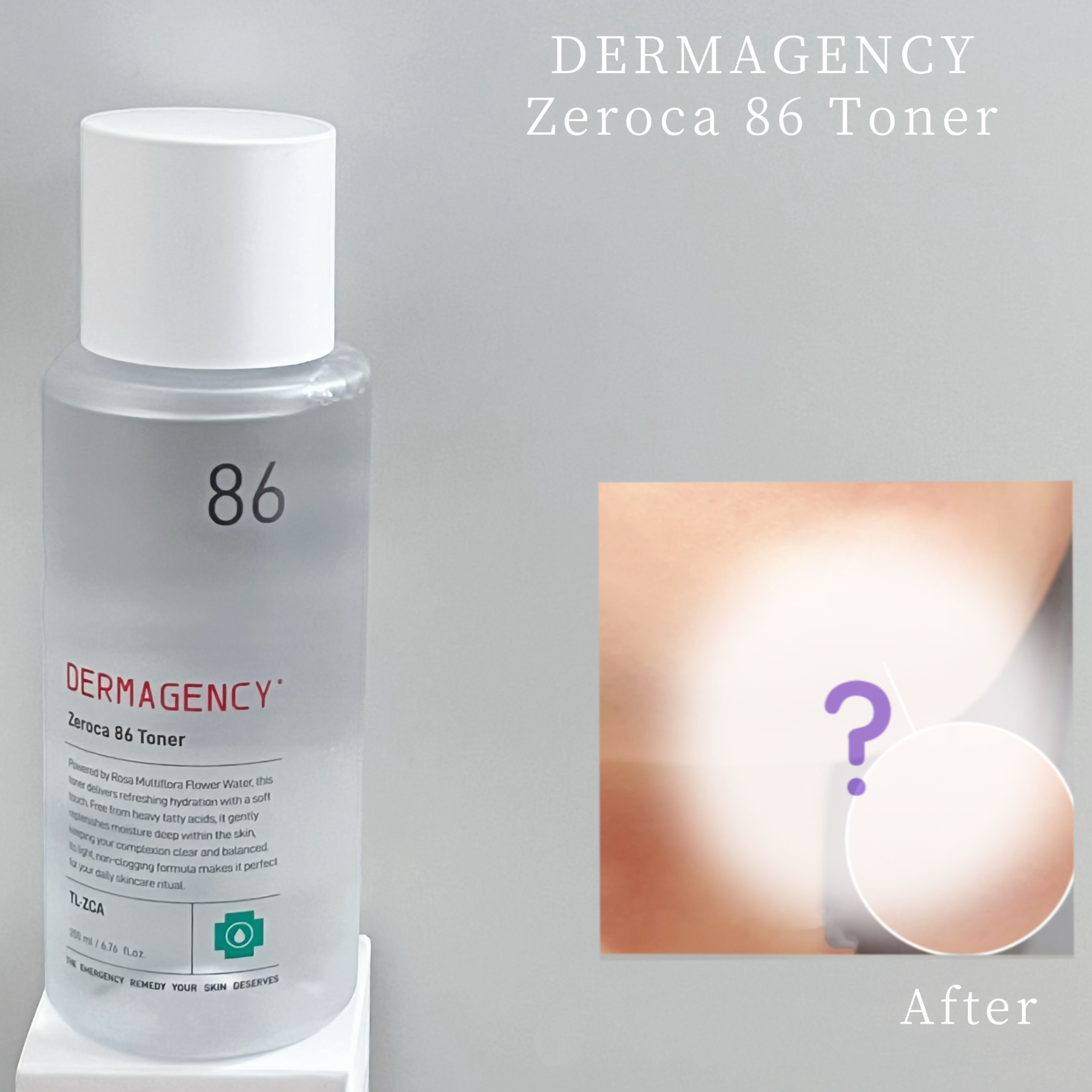 ダーマジェンシー ゼロカ86 トナー/DERMAGENCY/化粧水を使ったクチコミ（1枚目）