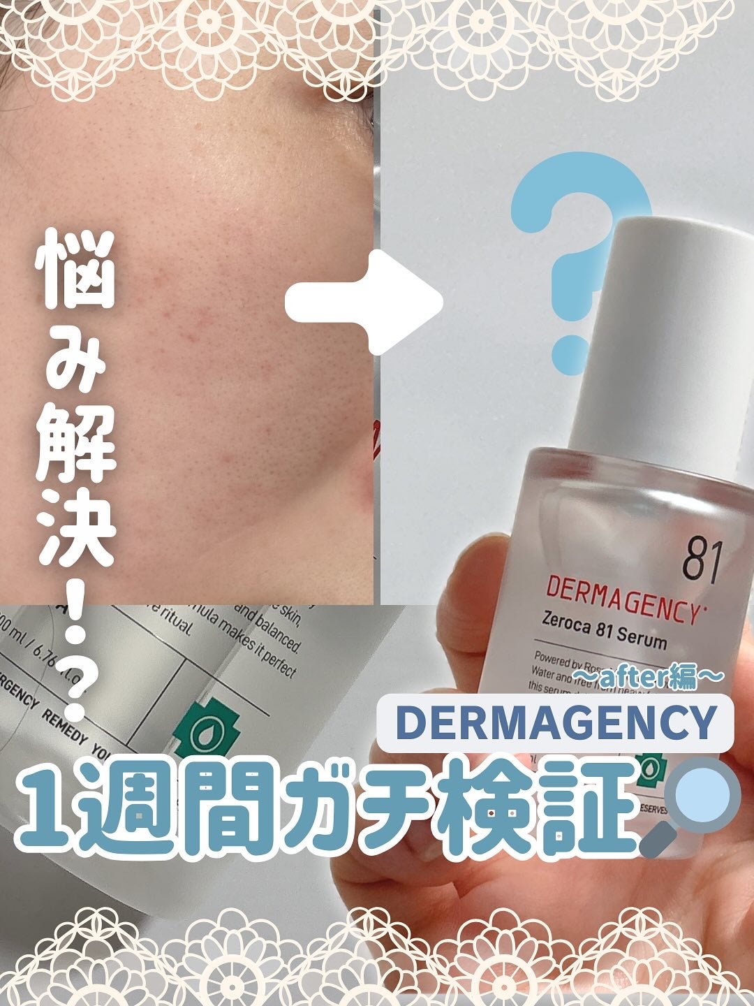 ダーマジェンシー ゼロカ81 セラム/DERMAGENCY/美容液を使ったクチコミ(1枚目)