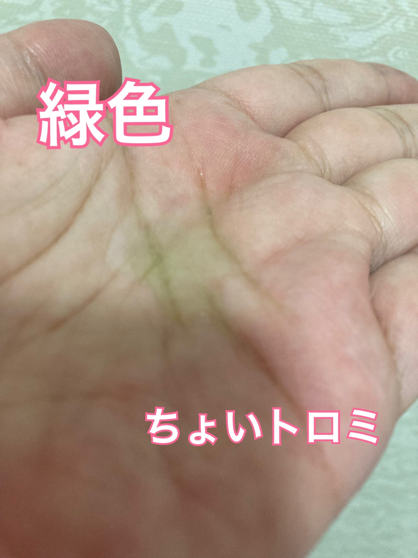 アゼライン酸15 インテンスカーミングセラム/Anua/美容液を使ったクチコミ(2枚目)