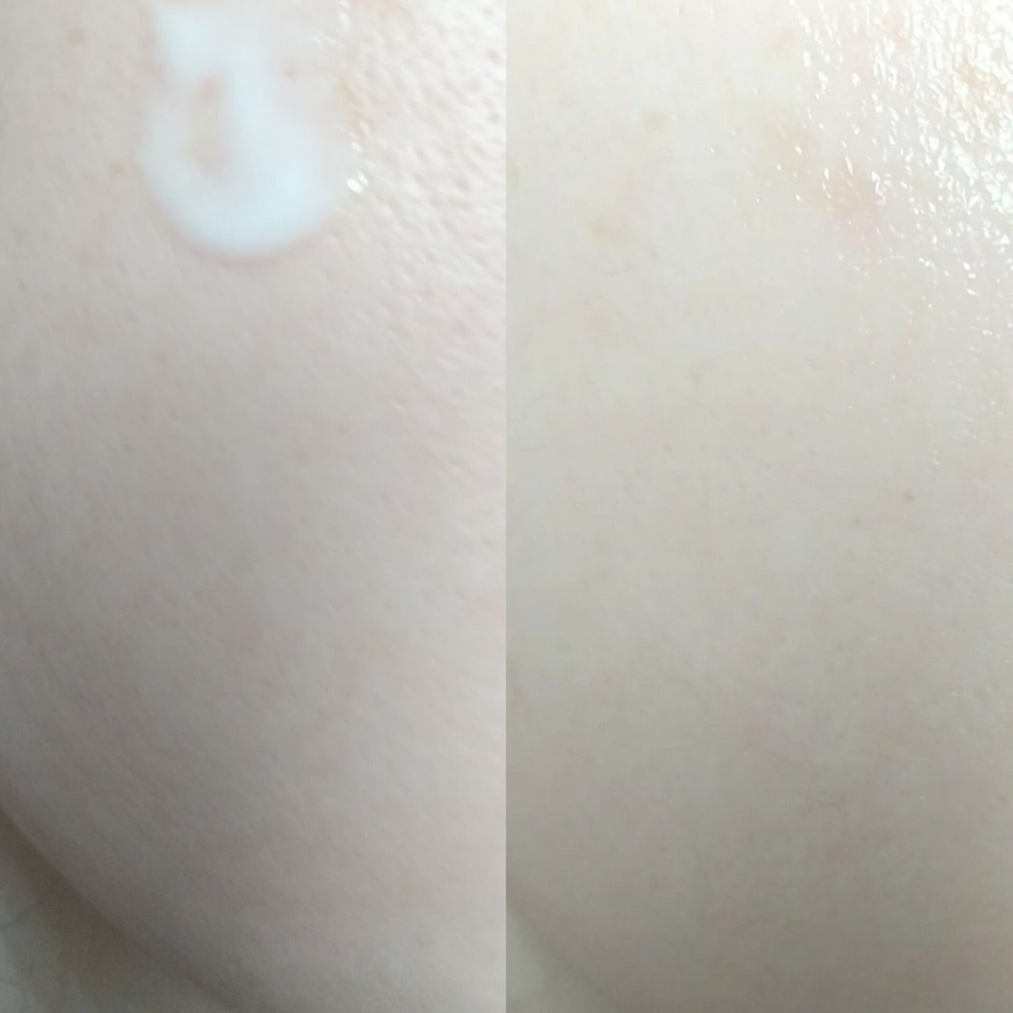 C+ ラディアンス セラム/アベンヌ/美容液を使ったクチコミ(5枚目)