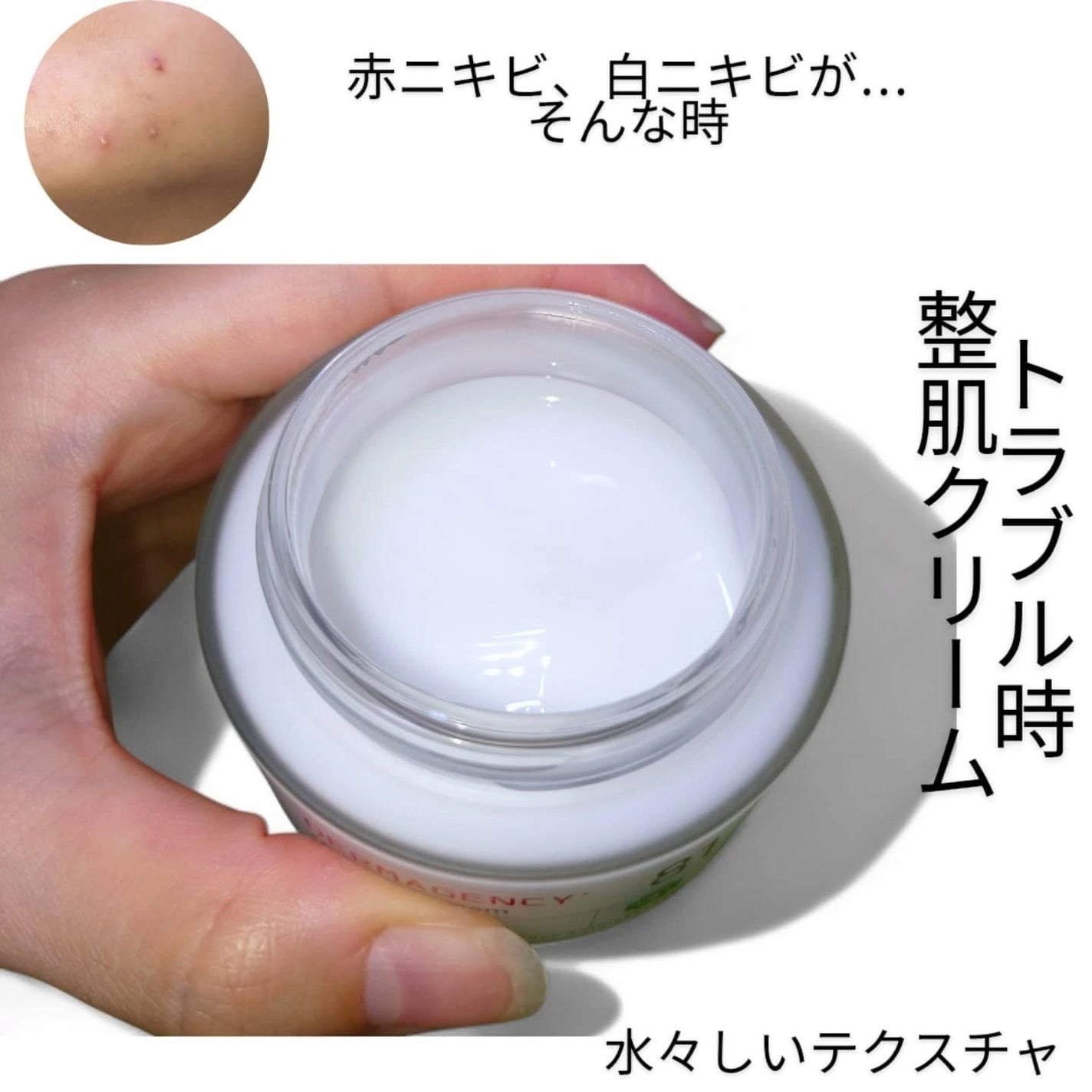 ダーマジェンシー ゼロカ81 クリーム/DERMAGENCY/フェイスクリームを使ったクチコミ(3枚目)