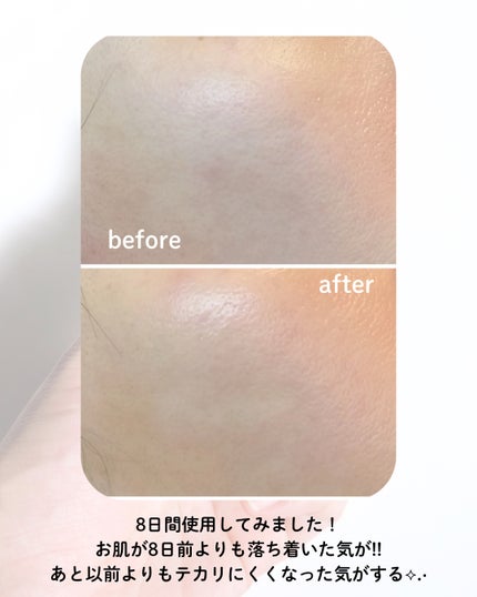 ダーマジェンシー ゼロカ81 セラム/DERMAGENCY/美容液を使ったクチコミ(4枚目)