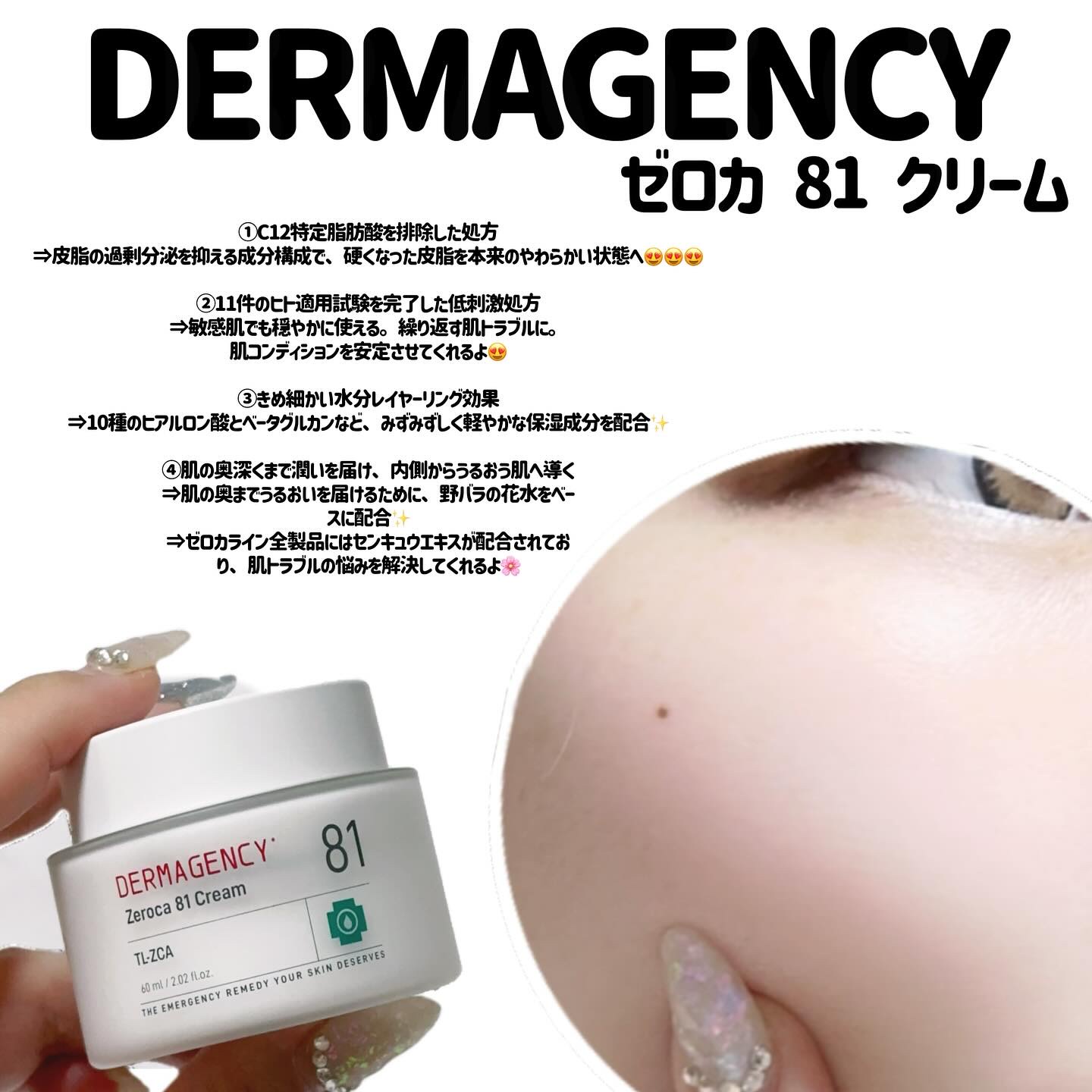 ダーマジェンシー ゼロカ81 クリーム/DERMAGENCY/フェイスクリームを使ったクチコミ（3枚目）