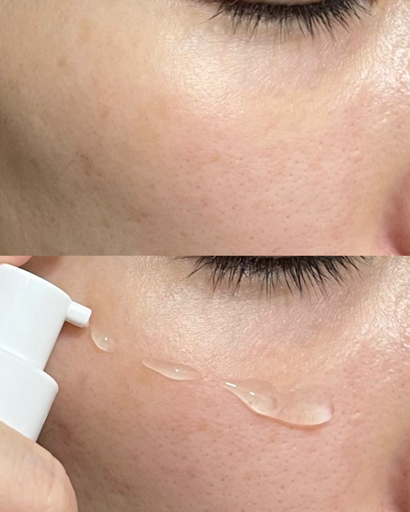 ダーマジェンシー ゼロカ81 セラム/DERMAGENCY/美容液を使ったクチコミ(5枚目)