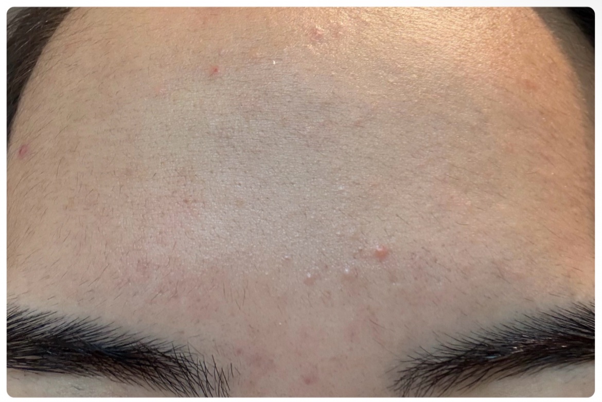 薬用雪肌精 ブライトニング クレンジング オイル[医薬部外品]/雪肌精/オイルクレンジングを使ったクチコミ（3枚目）