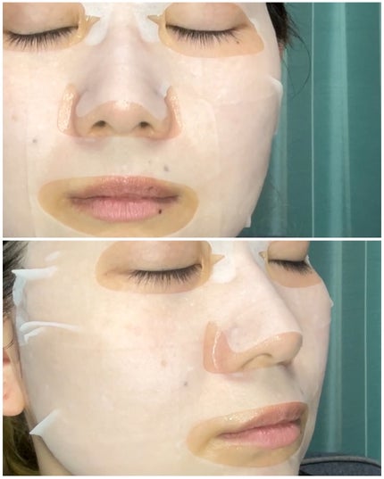 ノスカナイン T セラムマスク S/FATION/シートマスク・パックを使ったクチコミ(4枚目)