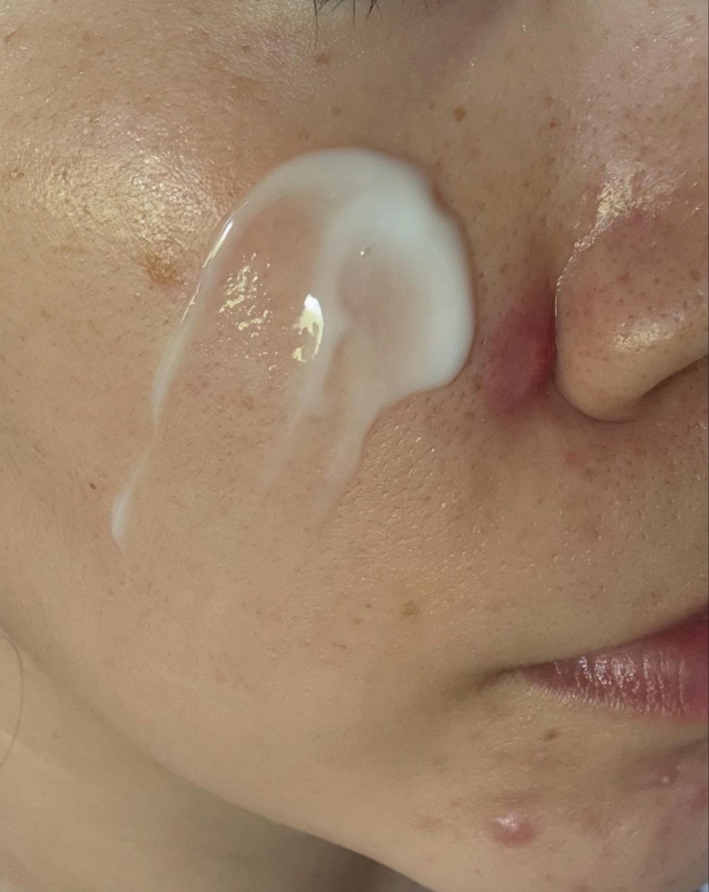 ダーマジェンシー ゼロカ81 クリーム/DERMAGENCY/フェイスクリームを使ったクチコミ(6枚目)