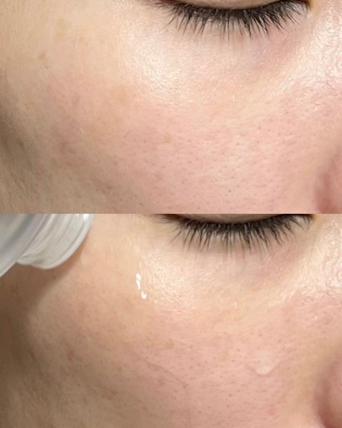 ダーマジェンシー ゼロカ86 トナー/DERMAGENCY/化粧水を使ったクチコミ(5枚目)