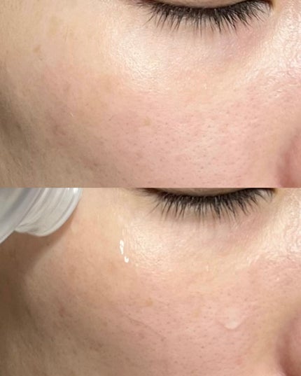 ダーマジェンシー ゼロカ86 トナー/DERMAGENCY/化粧水を使ったクチコミ(5枚目)