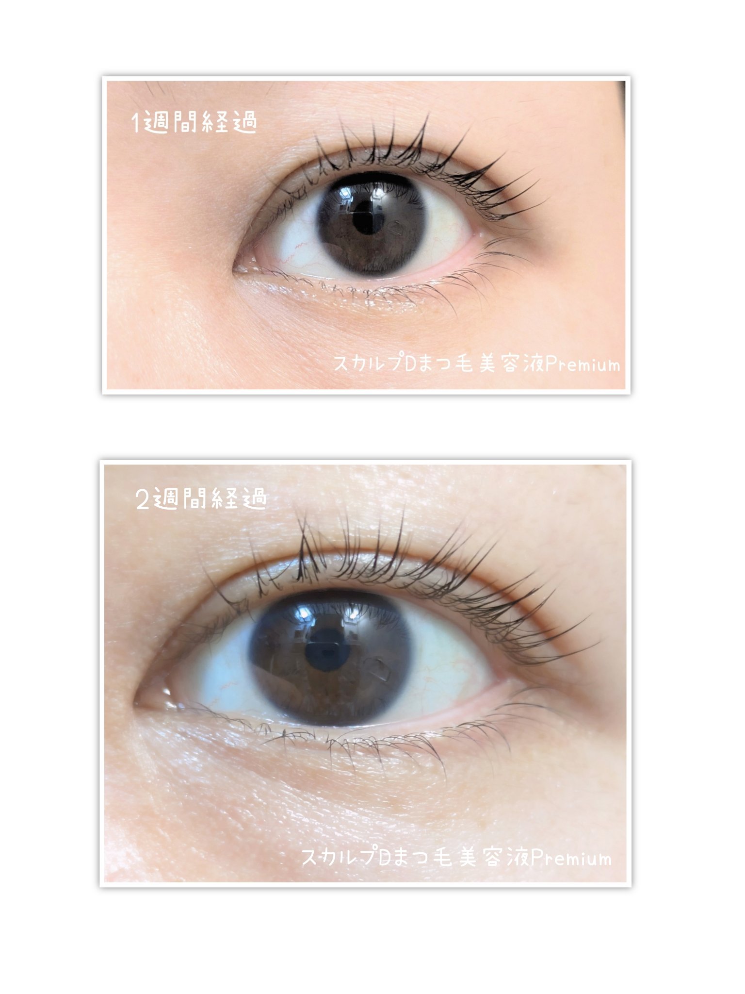 スカルプD アイラッシュセラム プレミアム/アンファー(スカルプD)/まつげ美容液を使ったクチコミ（2枚目）