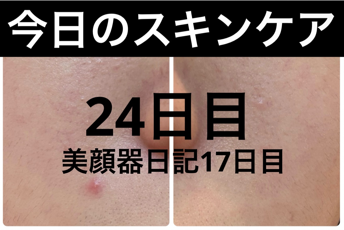 薬用雪肌精 ブライトニング クレンジング オイル[医薬部外品]/雪肌精/オイルクレンジングを使ったクチコミ（1枚目）