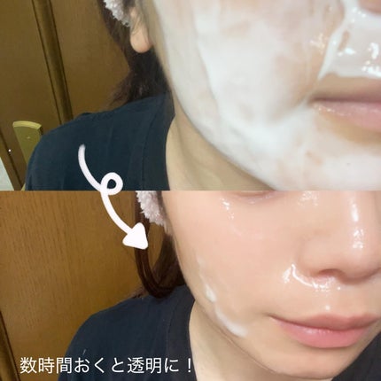 T1 コラーゲンプレミアムブラック/T1 collagen/洗い流すパック・マスクを使ったクチコミ(4枚目)