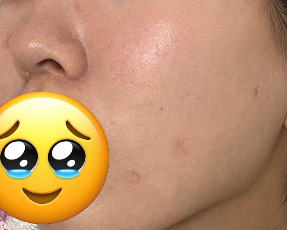 セカンドスキングロウクッション/hince/クッションファンデーションを使ったクチコミ(1枚目)