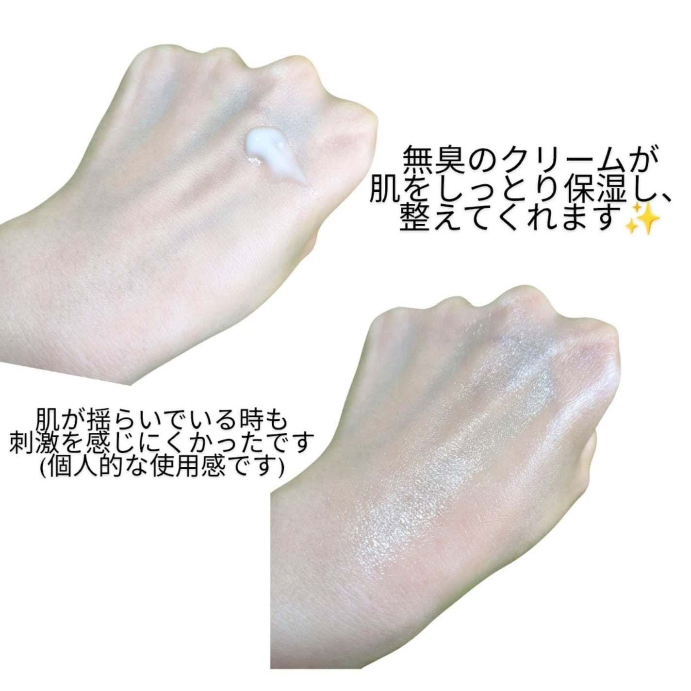 ダーマジェンシー ゼロカ81 クリーム/DERMAGENCY/フェイスクリームを使ったクチコミ(4枚目)