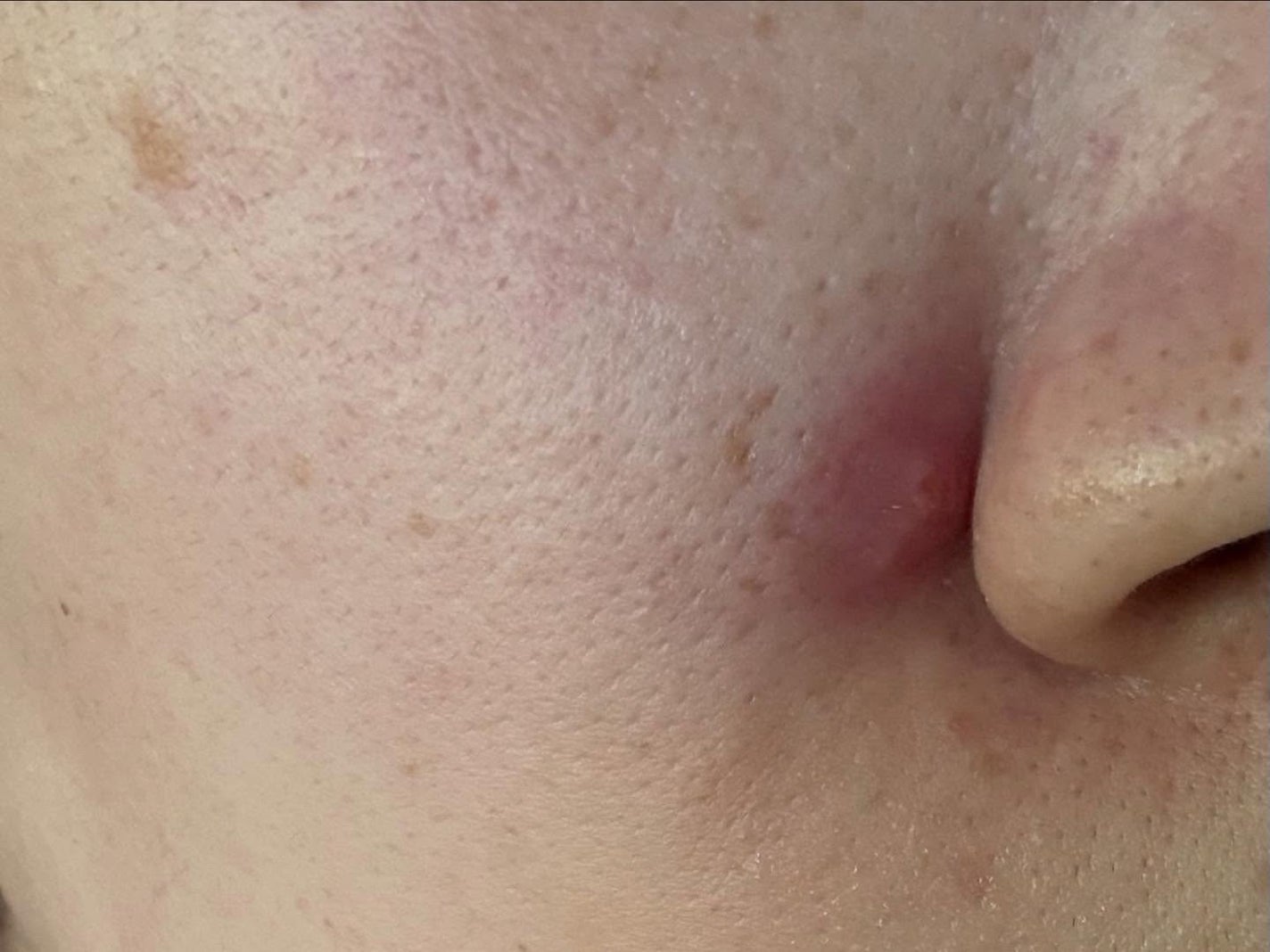 ダーマジェンシー ゼロカ86 トナー/DERMAGENCY/化粧水を使ったクチコミ(7枚目)