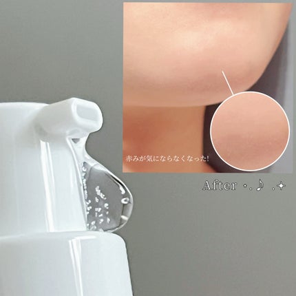 ダーマジェンシー ゼロカ81 セラム/DERMAGENCY/美容液を使ったクチコミ(5枚目)