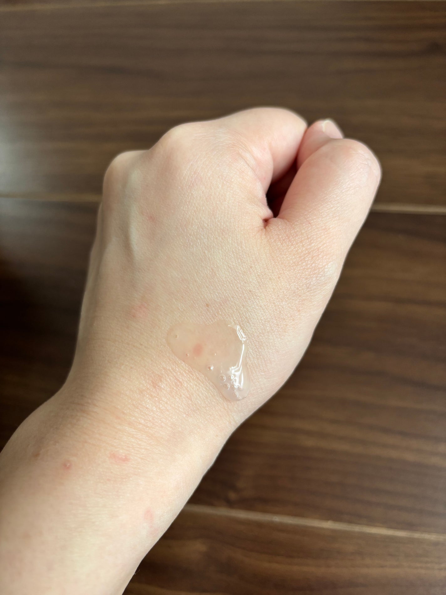 モイスチュア ローション/カルテHD/化粧水を使ったクチコミ(2枚目)