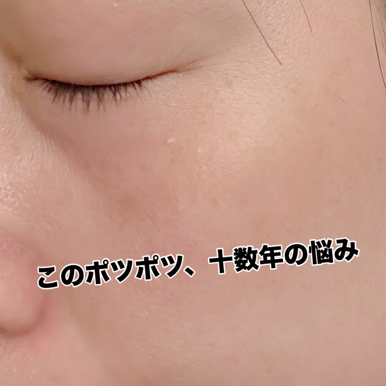 オーガニック ハトムギエキス (ヨクイニン)/KISO/その他を使ったクチコミ（2枚目）