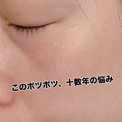 オーガニック ハトムギエキス (ヨクイニン)/KISO/その他を使ったクチコミ(2枚目)
