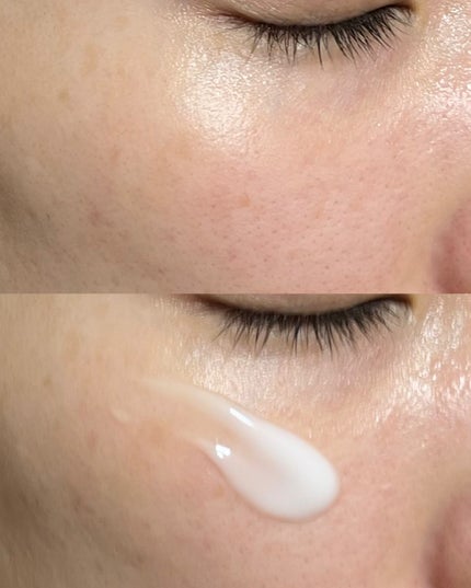 ダーマジェンシー ゼロカ81 クリーム/DERMAGENCY/フェイスクリームを使ったクチコミ(5枚目)