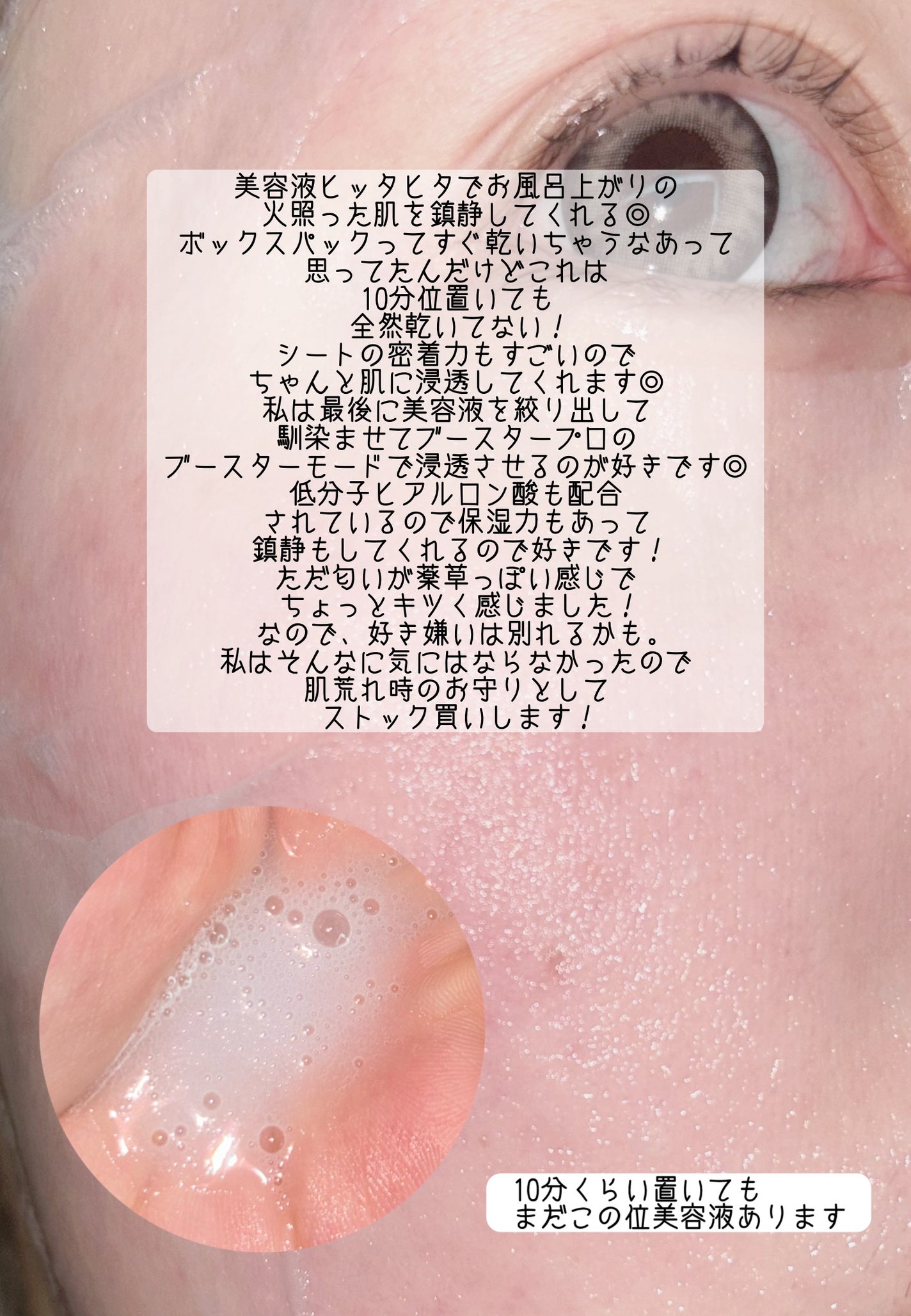 マデカッソシド ブレミッシュマスク/MEDIHEAL/シートマスク・パックを使ったクチコミ(2枚目)