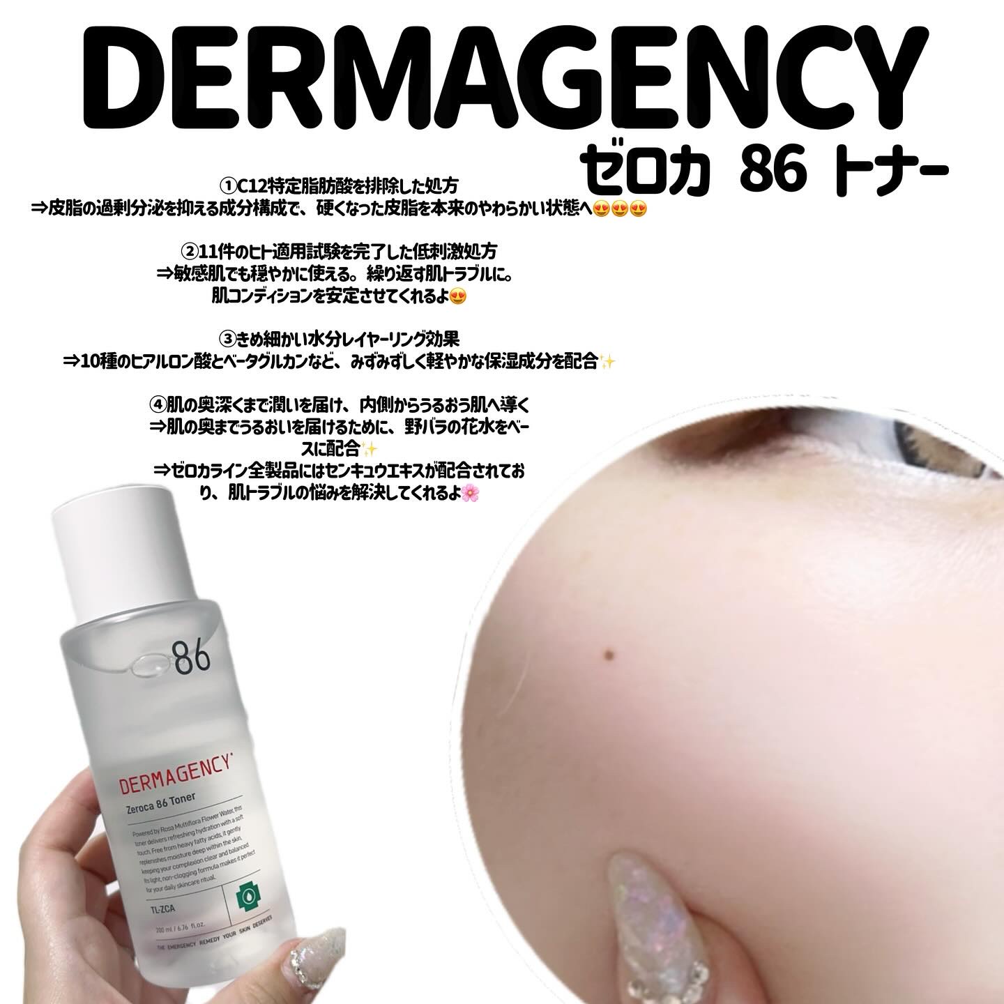 ダーマジェンシー ゼロカ86 トナー/DERMAGENCY/化粧水を使ったクチコミ（3枚目）