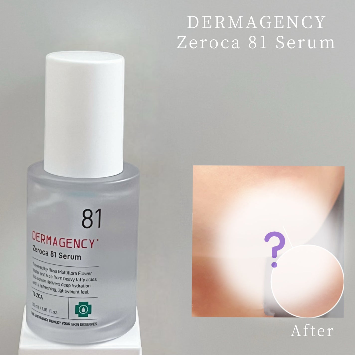 ダーマジェンシー ゼロカ81 セラム/DERMAGENCY/美容液を使ったクチコミ(1枚目)