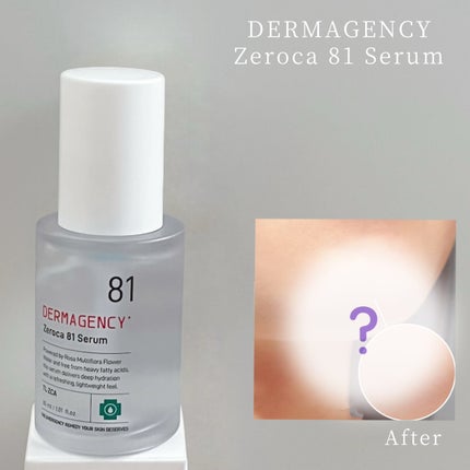 ダーマジェンシー ゼロカ81 セラム/DERMAGENCY/美容液を使ったクチコミ(1枚目)