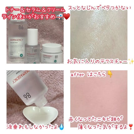 ダーマジェンシー ゼロカ86 トナー/DERMAGENCY/化粧水を使ったクチコミ(2枚目)