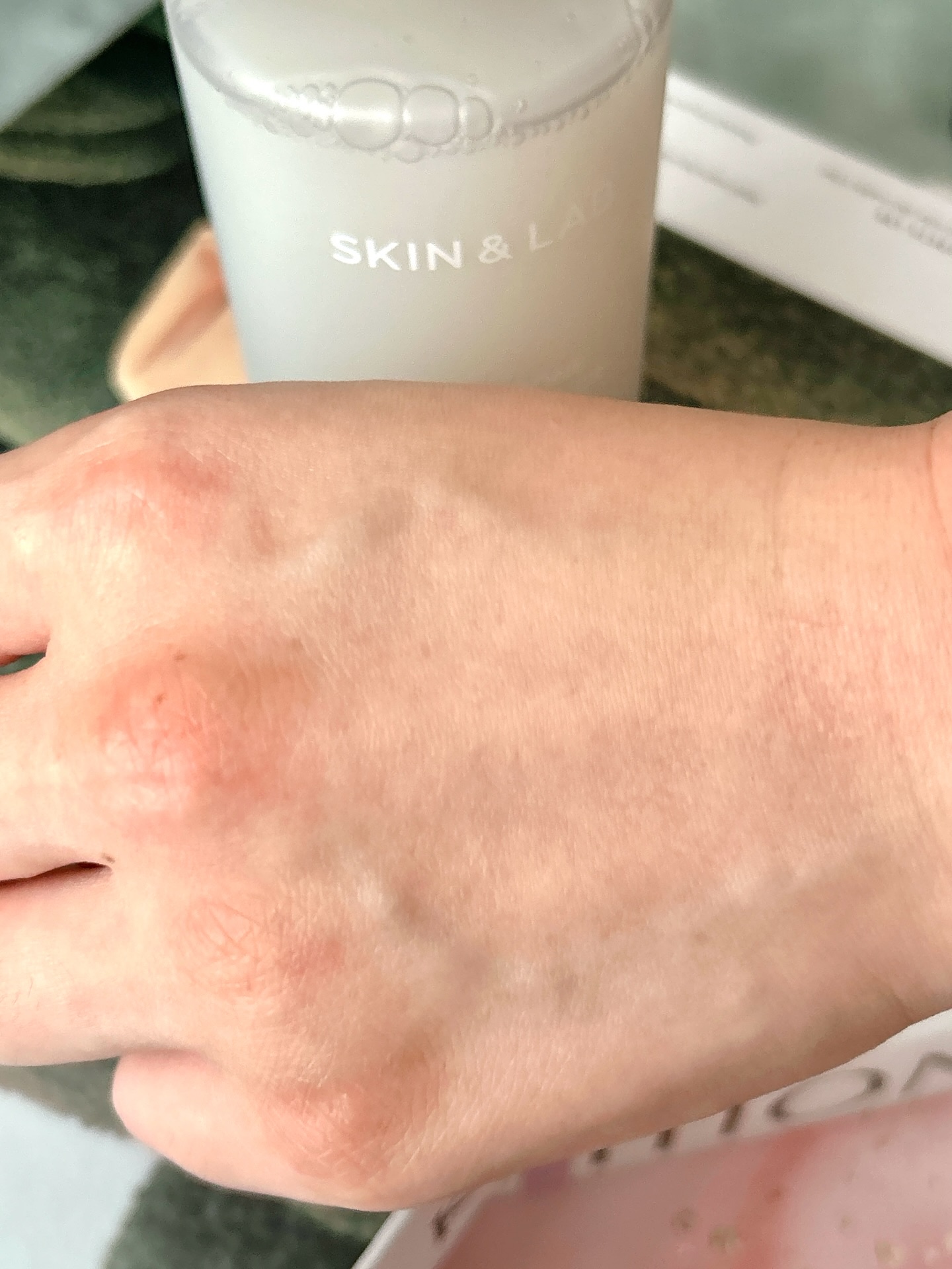 を使ったクチコミ（3枚目）