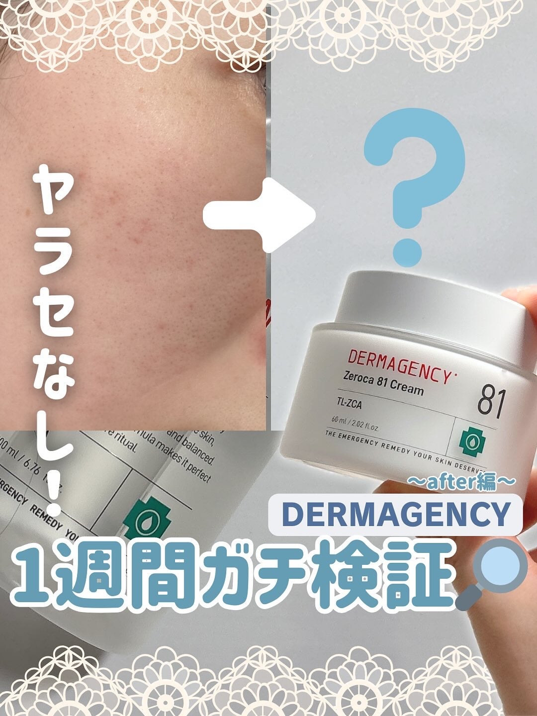 ダーマジェンシー ゼロカ81 クリーム/DERMAGENCY/フェイスクリームを使ったクチコミ(1枚目)