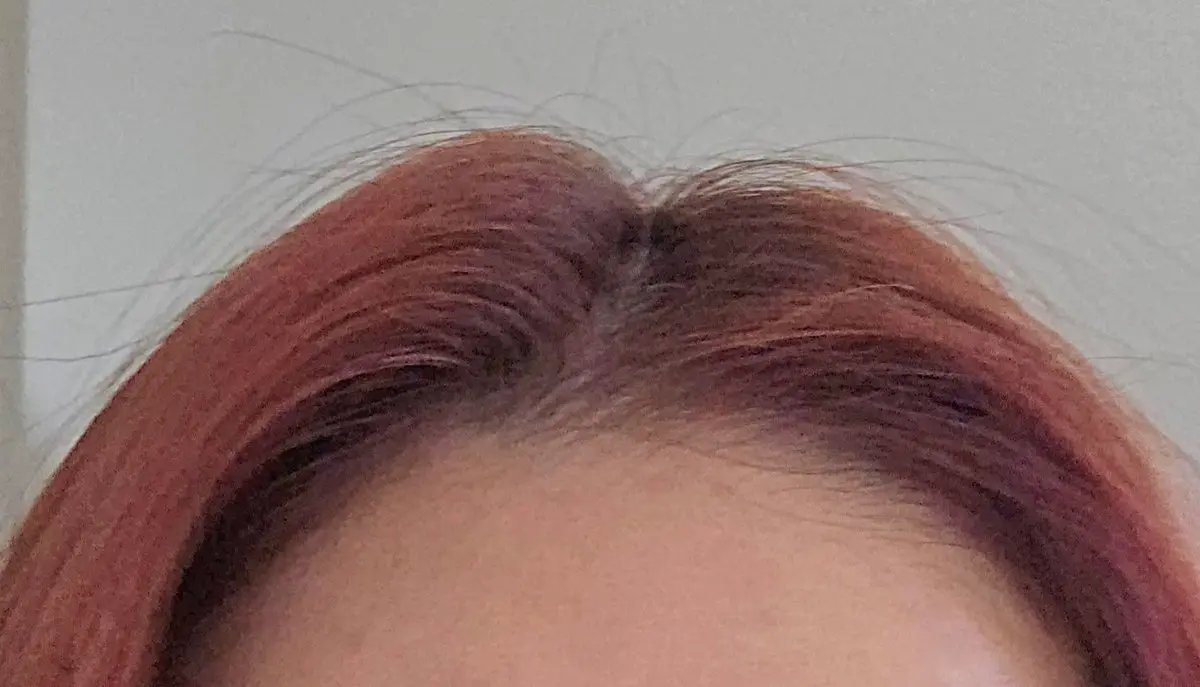 グローターンヘアアンプル/リリーイブ/頭皮ローションを使ったクチコミ（3枚目）