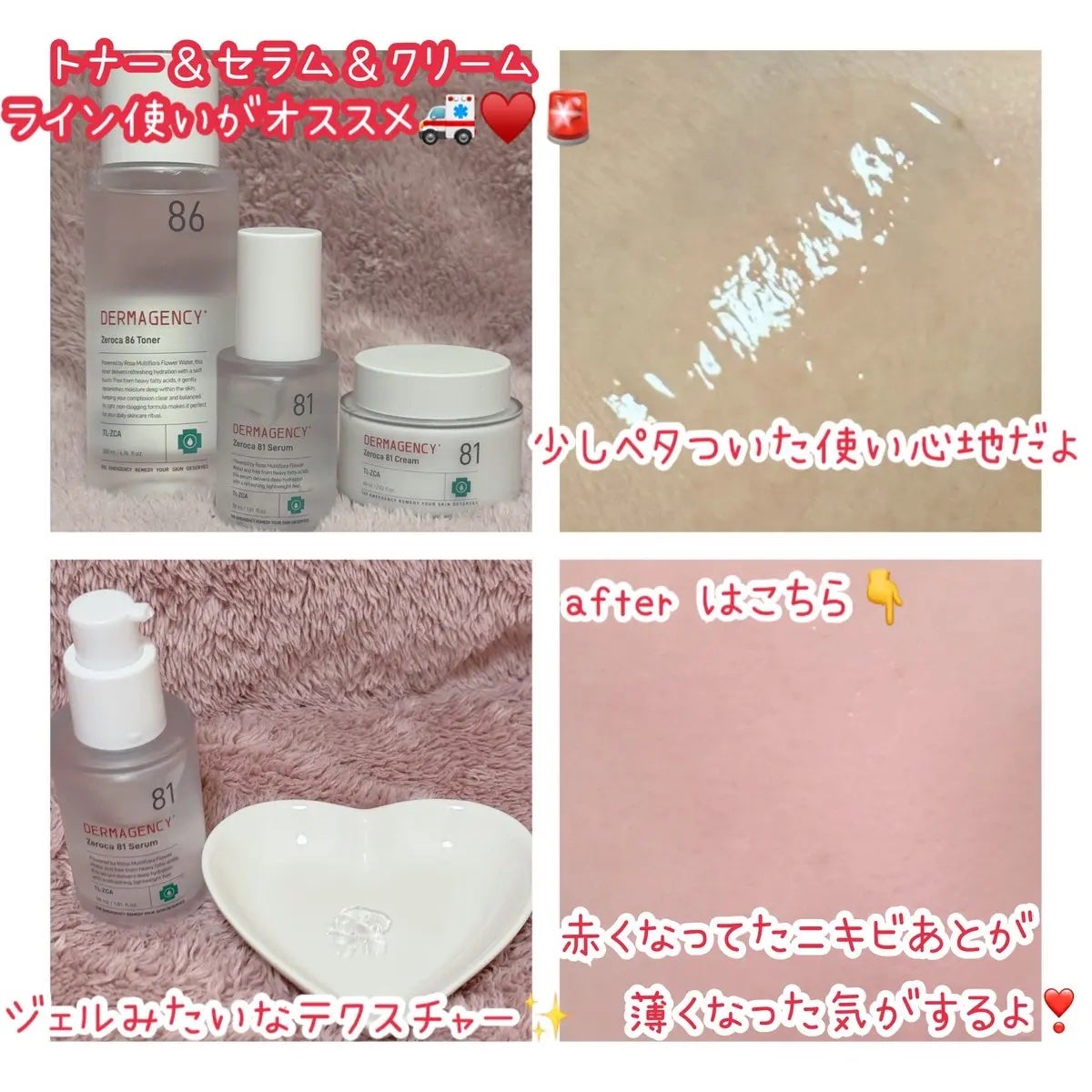 ダーマジェンシー ゼロカ81 セラム/DERMAGENCY/美容液を使ったクチコミ(2枚目)